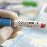 আমার কভিড টেস্টের রেজাল্ট !